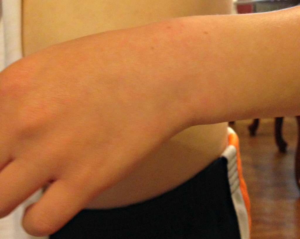 eczema wrapesoothe