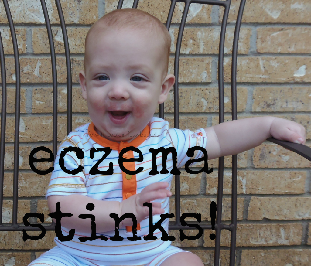 eczemastinks