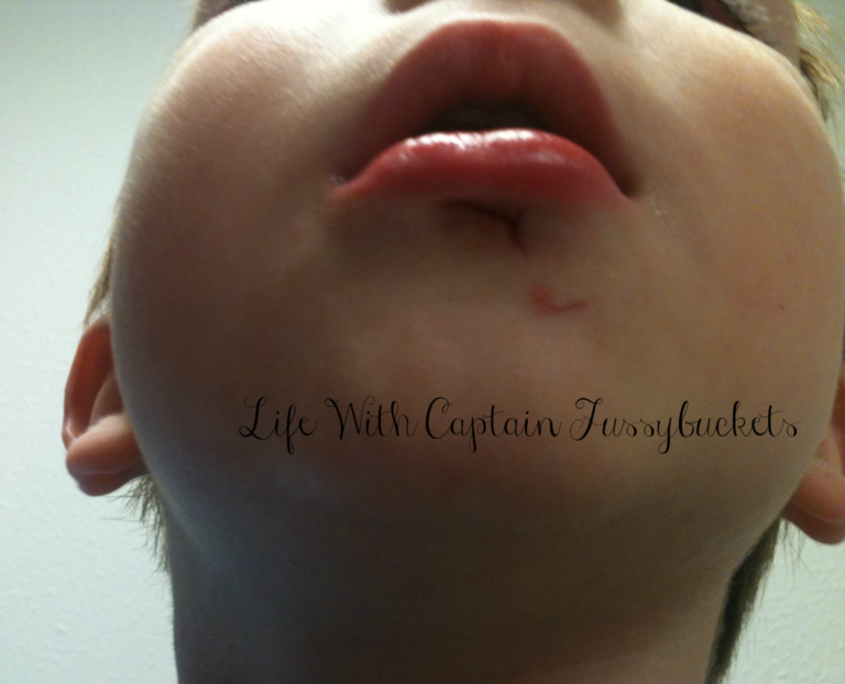 Raising Boys:  Accidents Happen!