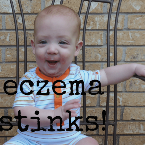 Eczema Stinks….But Non-Toxic Dream Cream is Here to Save the Day!