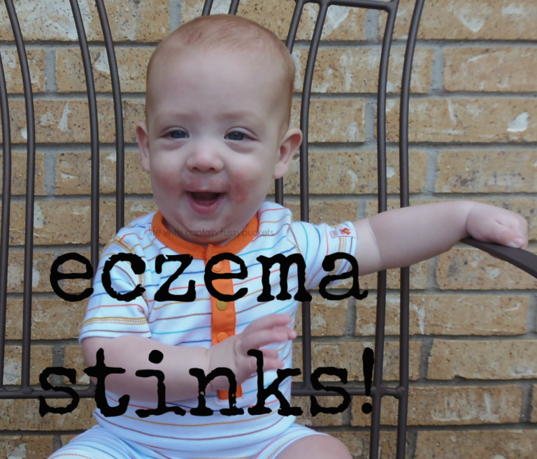 Eczema Stinks....But Non-Toxic Dream Cream is Here to Save the Day!