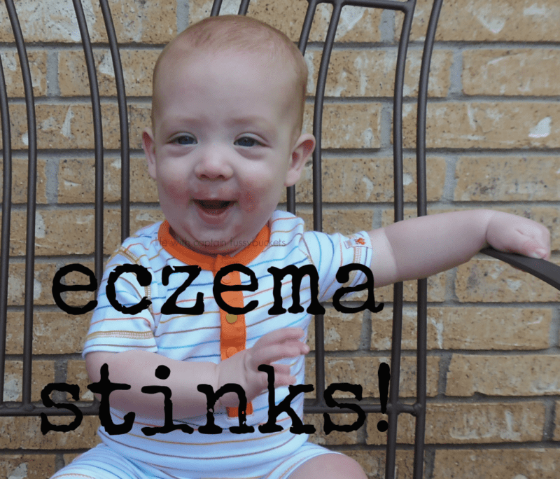 Eczema Stinks...But NonToxic Dream Cream Is Here to Save the Day!